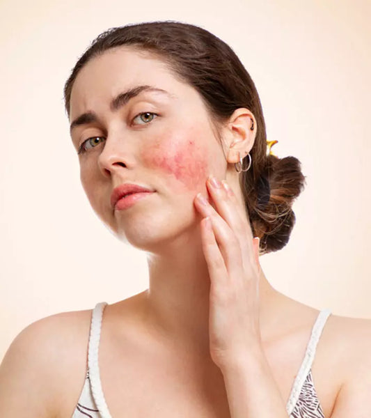 Skin inflammation