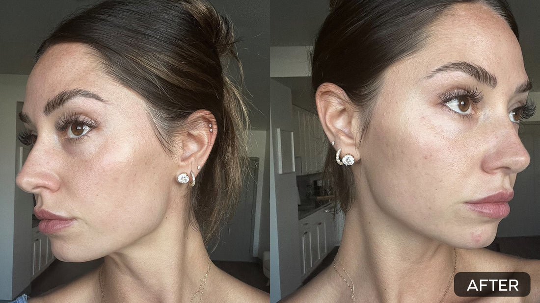 Exploring the Anti-Inflammatory Properties of Luminel Skincare Products